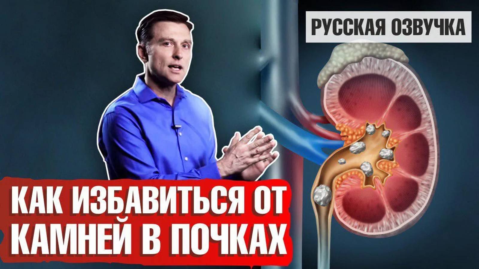 Камни в почках: Как избавиться?