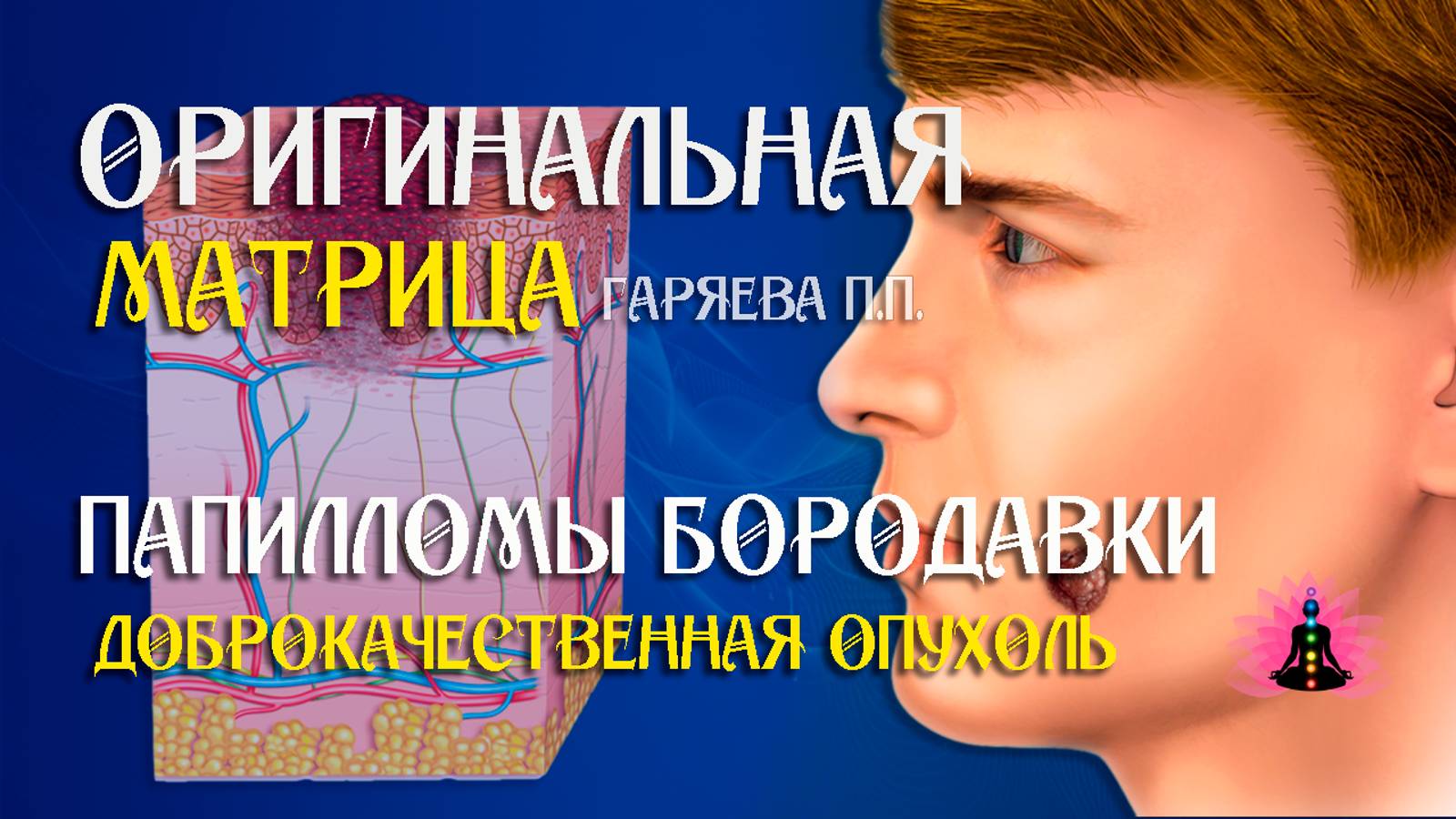 Вирус папилломы, бородавки ⚠️ Оригинальная программа матрица по технологии Гаряева ☀️ SoftRadio.ru