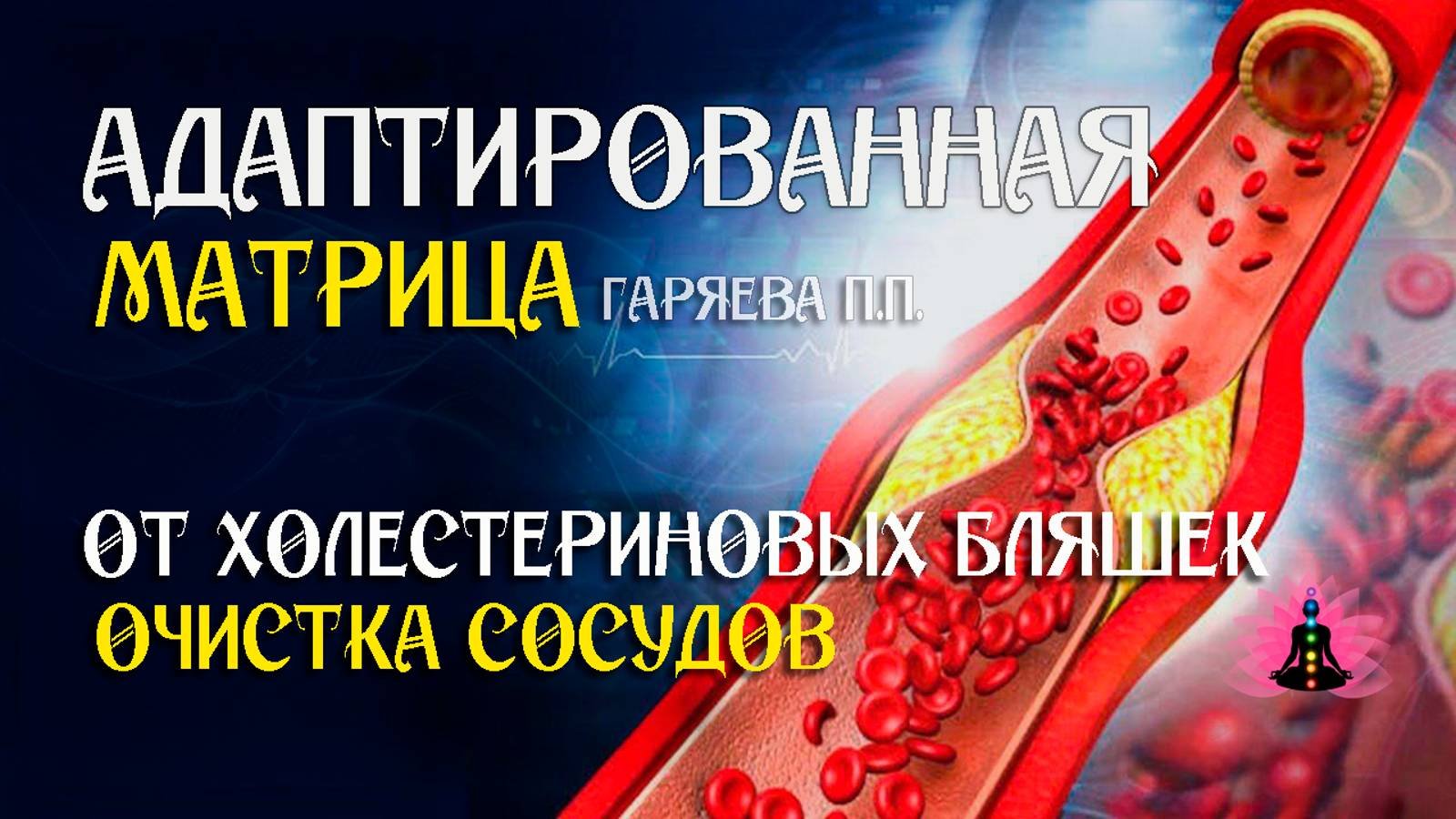 Очистка сосудов от холестериновых бляшек 🌀 Адаптированная программа матрица ☀️ SoftRadio.ru