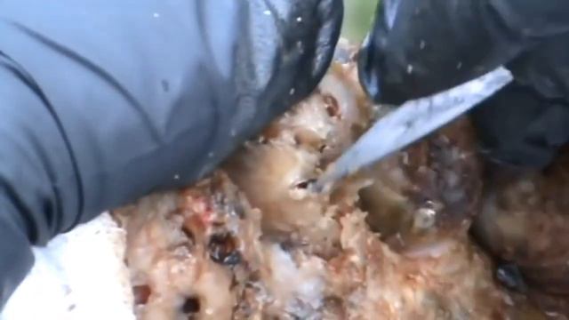 Jiggers Torn Off l One Of The Scariest Feet In Africa v4