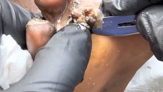 Jigger digging Wesley - to watch full video, please subscribe @riseupsociety.net