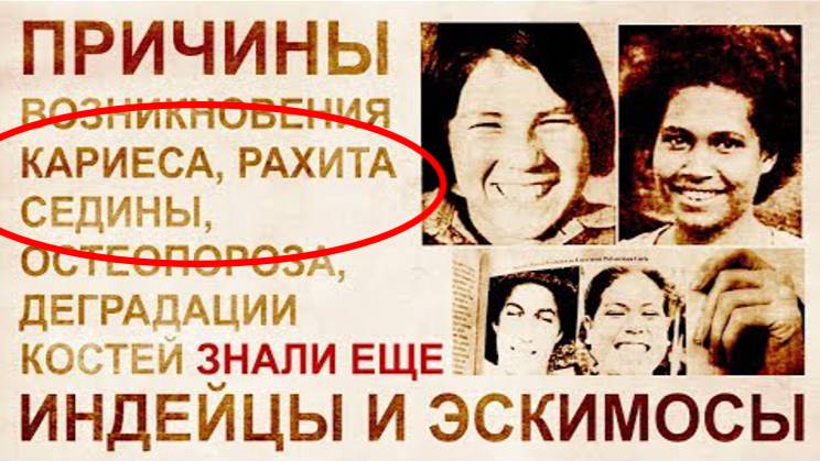 ⚡ Причина КАРИЕСА, седина, кривые ЗУБЫ ...