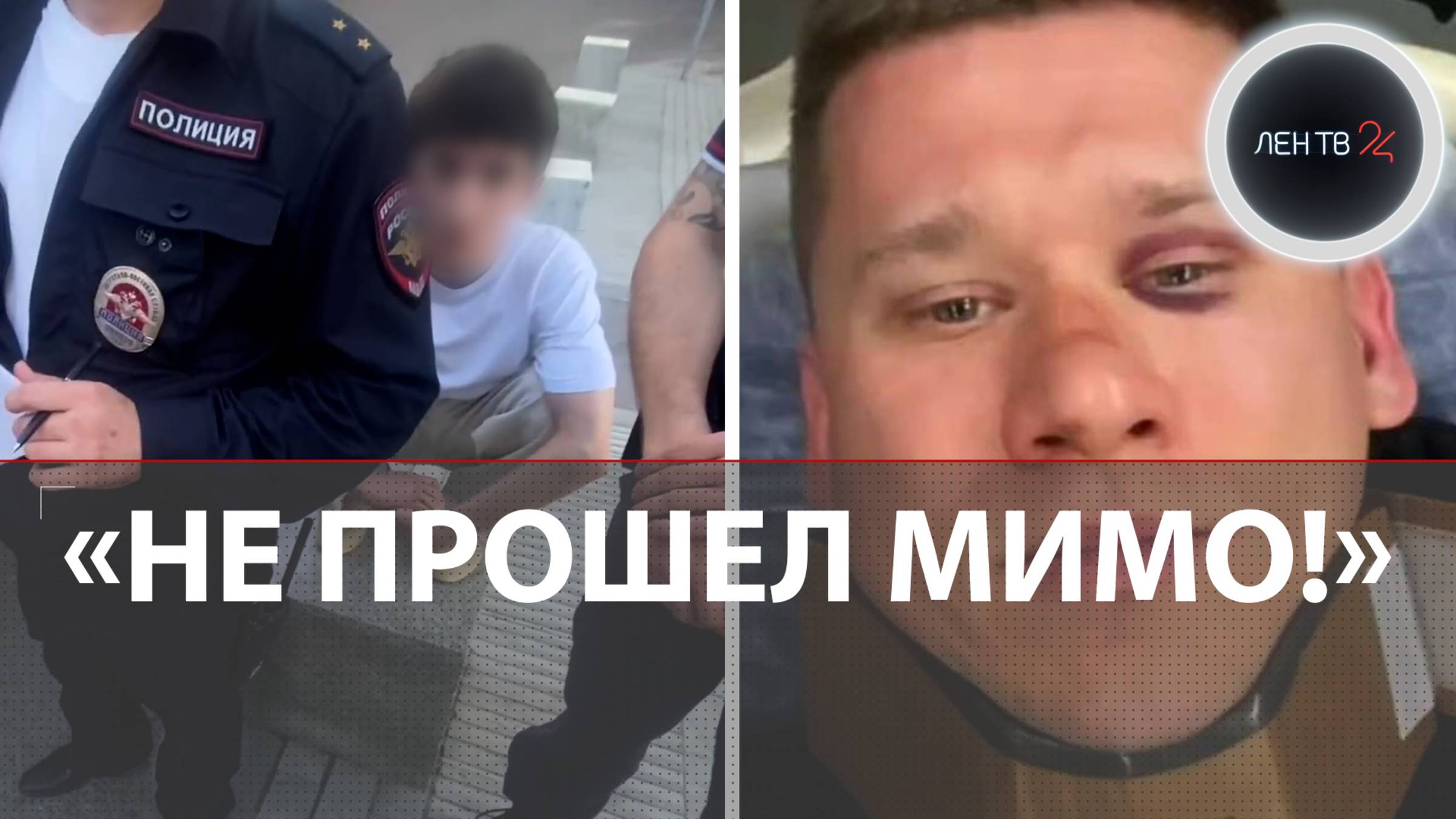 «Зачем ты бьешь меня по попе?!»: в Твери избили фотографа, который заступился за девушку