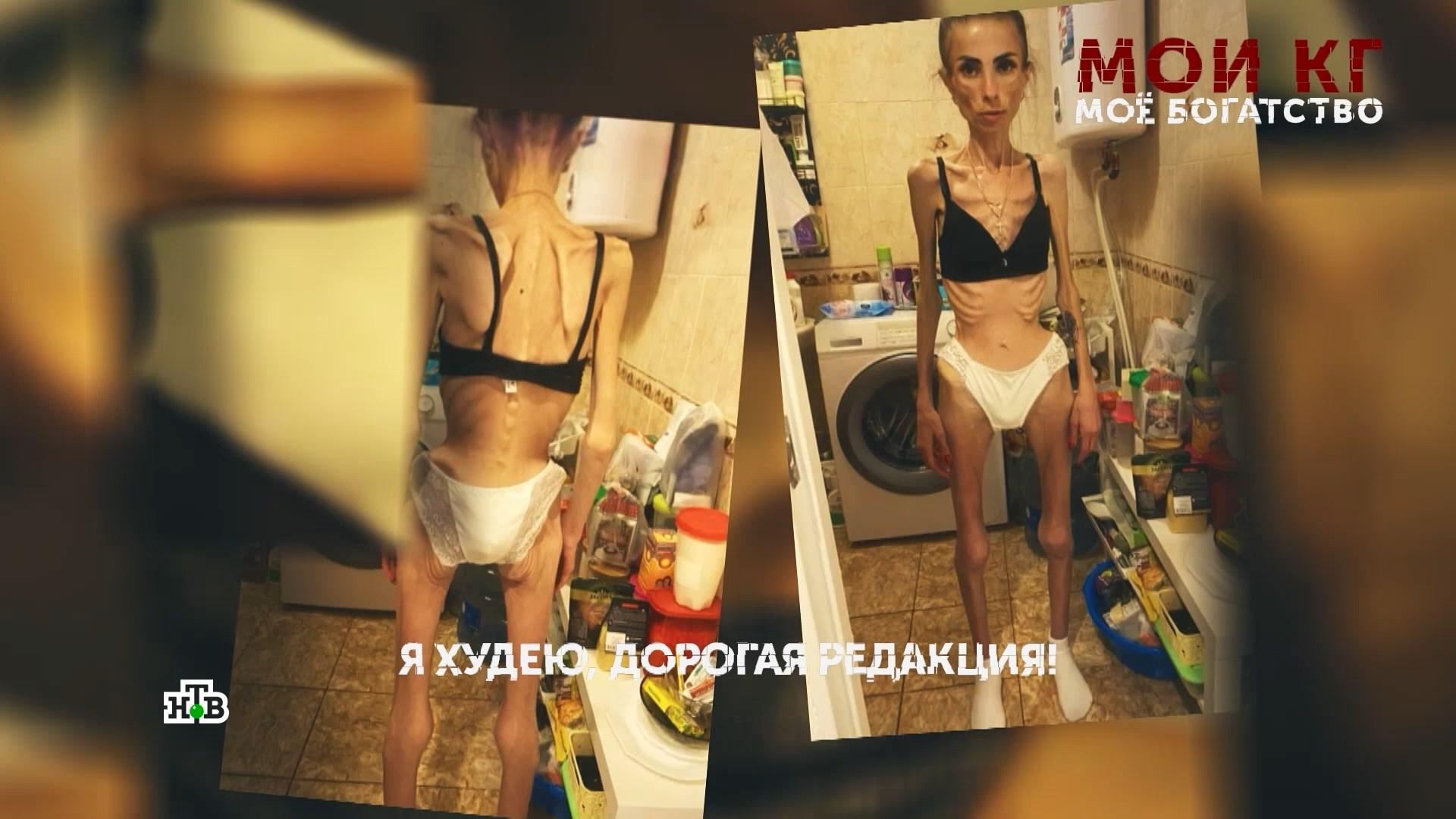 «Мои кг — мое богатство». 2 серия | «Основано на реальных событиях»