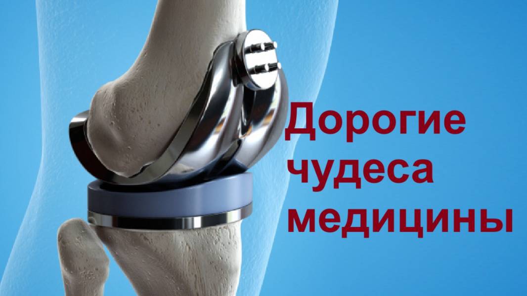 Дорогие чудеса медицины