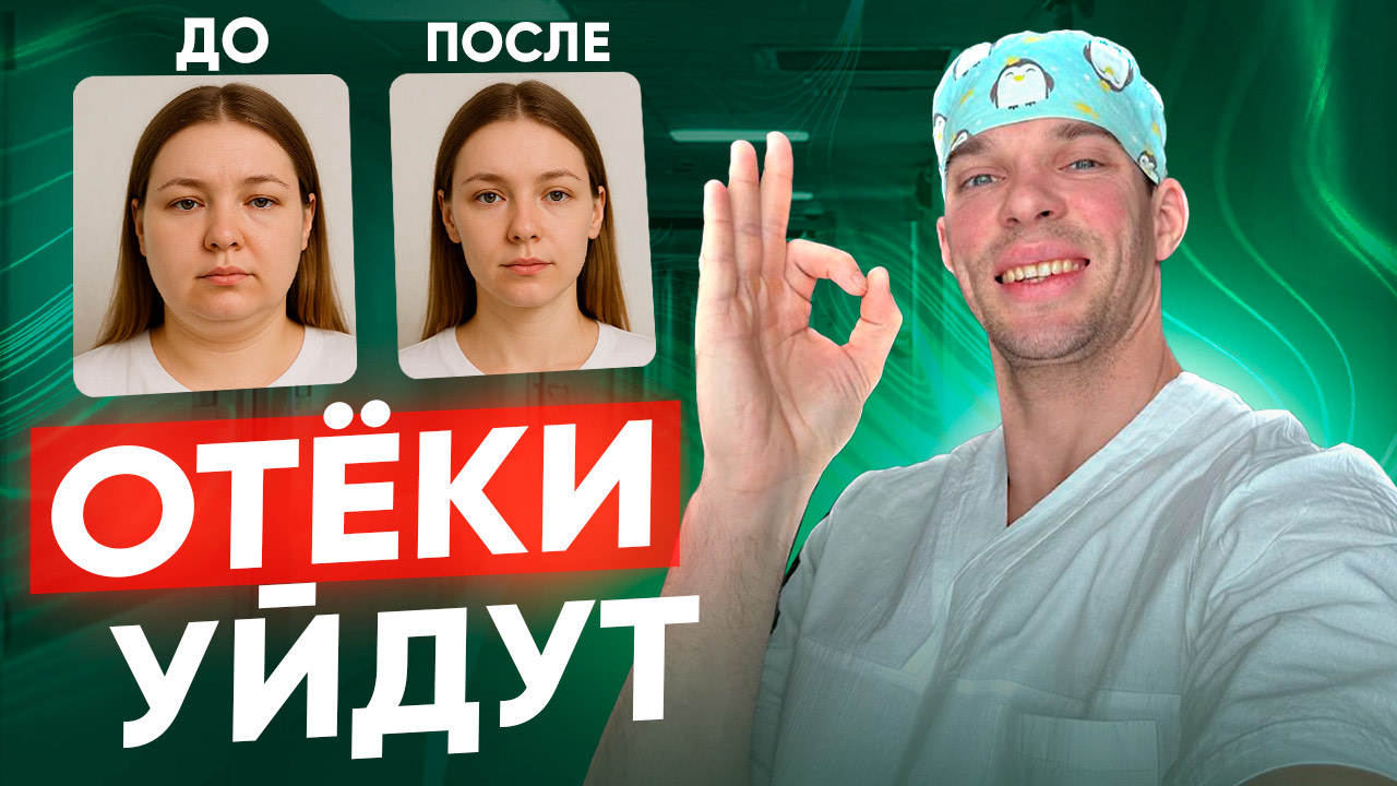 Как убрать ОТЁКИ во всём теле.