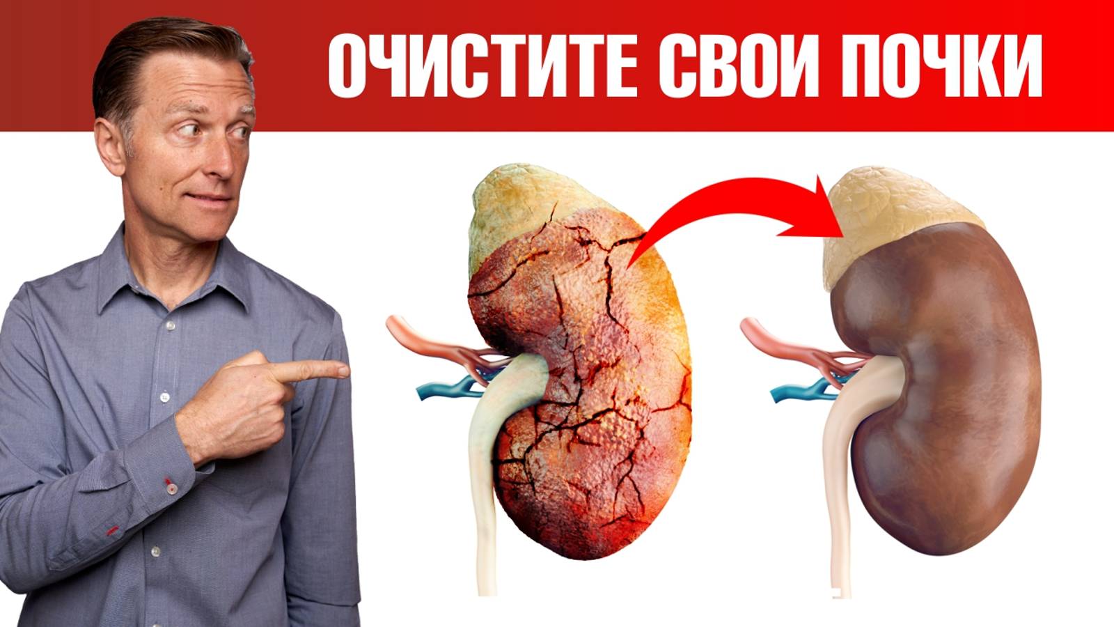 Детоксикация почек: необычный способ. Почему детокс почек так важен🤔