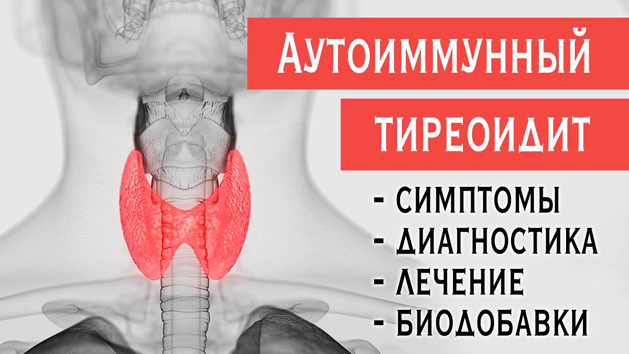 Аутоиммунный тиреоидит (АИТ, зоб Хашимото): симптомы гипотиреоза, диагностика, лечение, биодобавки.
