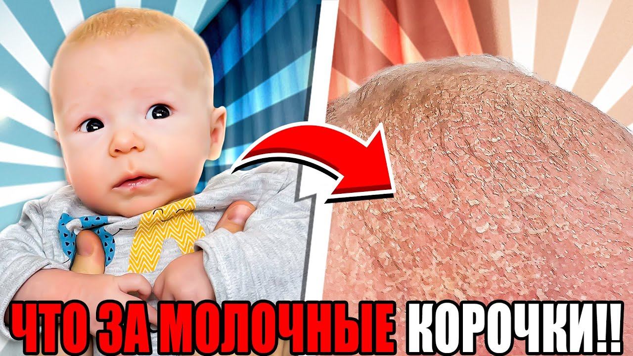 ЧТО С ГОЛОВОЙ МАТВЕЯ!? ЧТО ДЕЛАТЬ?