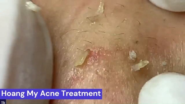 New POPPING videos 2023