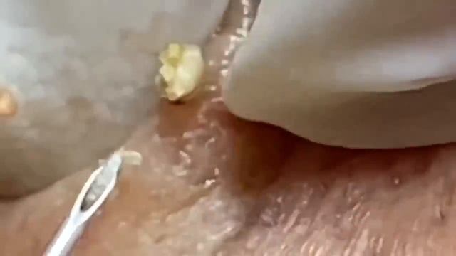 Enjoy Every Day With Loan Nguyen Spa Beauty New Video | 001