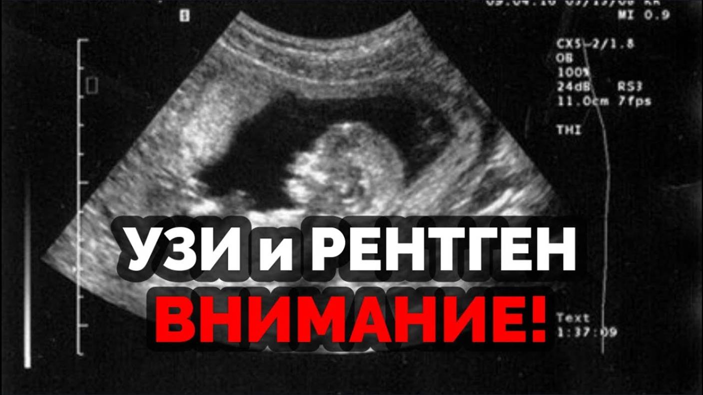 УЗИ И РЕНТГЕН: ВНИМАНИЕ!