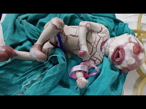 9 Необычных Детей, Которые Действительно Существуют