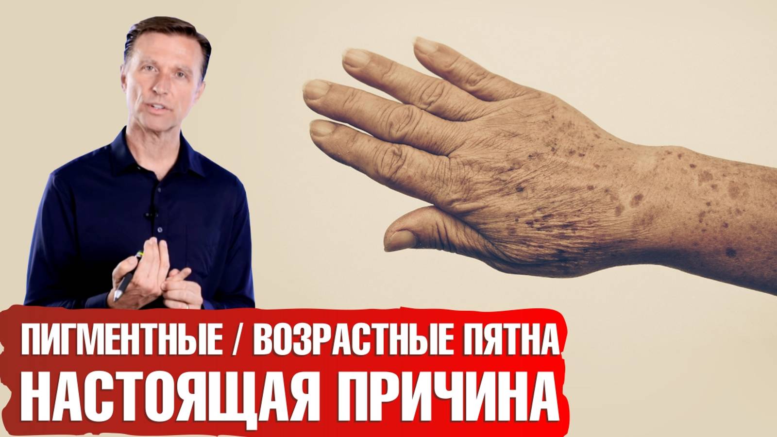 Возрастные пигментные пятна. Как избавиться от печеночных пятен