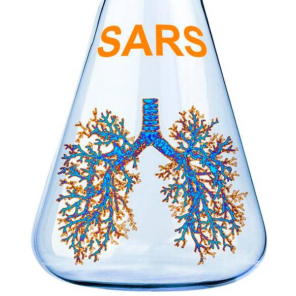 SARS